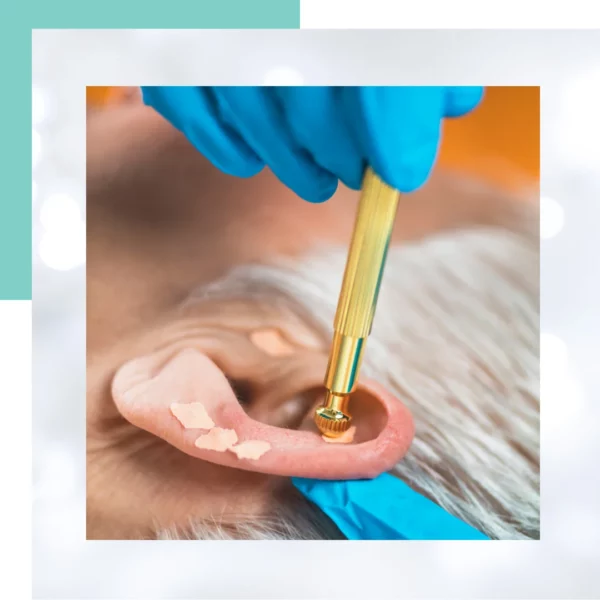 auriculoterapia para tratamiento en bogota